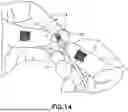 Fig. 16 - System and Method for Vascular Access Management