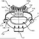 Fig. 01 - A PROCEDURAL SEDATION MOUTHPIECE