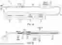 Fig. 02 - BILATERAL MECHANICAL CIRCULATORY SUPPORT SYSTEM