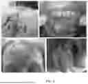 Fig. 02 - COMPOSITIONS AND METHODS FOR TREATING DISEASE