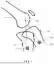 Fig. 02 - Referencing of Anatomical Structure