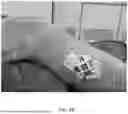 Fig. 06 - Referencing of Anatomical Structure