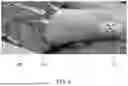 Fig. 08 - Referencing of Anatomical Structure