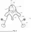 Fig. 10 - Referencing of Anatomical Structure