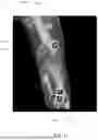 Fig. 13 - Referencing of Anatomical Structure