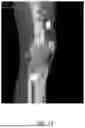 Fig. 14 - Referencing of Anatomical Structure