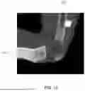 Fig. 15 - Referencing of Anatomical Structure
