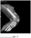 Fig. 16 - Referencing of Anatomical Structure