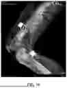 Fig. 17 - Referencing of Anatomical Structure