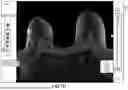 Fig. 24 - MULTIMODALITY HANGING PROTOCOLS