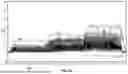 Fig. 12 - METHOD AND SYSTEMS FOR HEART CONDITION DETECTION USING AN ACCELEROMETER