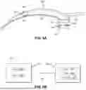 Fig. 06 - UNIVERSAL LARYNGOSCOPE BLADE