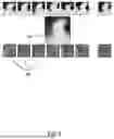 Fig. 06 - A METHOD AND SYSTEM FOR DETERMINING A MODEL OF A CARDIAC IMPLANT