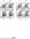 Fig. 09 - A METHOD AND SYSTEM FOR DETERMINING A MODEL OF A CARDIAC IMPLANT