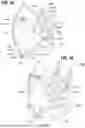 Fig. 22 - MECHANICALLY EXPANDABLE HEART VALVE
