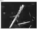 Fig. 06 - CRYSTALLINE FORM OF ANSERINE, AND METHOD OF PRODUCING THE CRYSTALLINE FORM OF ANSERINE