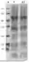Fig. 01 - CHIMERIC PAPILLOMAVIRUS L1 PROTEIN