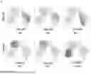 Fig. 09 - CD95 POLYPEPTIDES