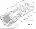 Fig. 04 - Firearm muzzle attachment apparatus