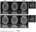 Fig. 05 - DYNAMIC DISTORTION CORRECTION FOR MRI USING FID NAVIGATORS