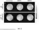 Fig. 10 - DYNAMIC DISTORTION CORRECTION FOR MRI USING FID NAVIGATORS