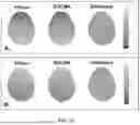 Fig. 11 - DYNAMIC DISTORTION CORRECTION FOR MRI USING FID NAVIGATORS