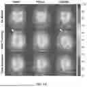 Fig. 14 - DYNAMIC DISTORTION CORRECTION FOR MRI USING FID NAVIGATORS