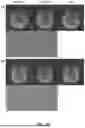 Fig. 25 - DYNAMIC DISTORTION CORRECTION FOR MRI USING FID NAVIGATORS
