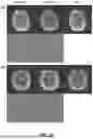 Fig. 26 - DYNAMIC DISTORTION CORRECTION FOR MRI USING FID NAVIGATORS