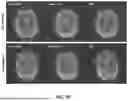 Fig. 29 - DYNAMIC DISTORTION CORRECTION FOR MRI USING FID NAVIGATORS