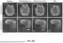 Fig. 30 - DYNAMIC DISTORTION CORRECTION FOR MRI USING FID NAVIGATORS