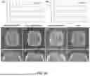 Fig. 31 - DYNAMIC DISTORTION CORRECTION FOR MRI USING FID NAVIGATORS