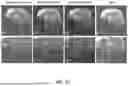 Fig. 32 - DYNAMIC DISTORTION CORRECTION FOR MRI USING FID NAVIGATORS