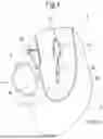 Fig. 02 - Mouse and Replacement Support Kit