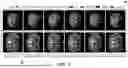 Fig. 09 - IMAGE SEGMENTATION SYSTEM VIA GRAPH OR MULTISCALE CASCADED ATTENTION DECODING