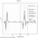 Fig. 09 - LEAKAGE ELECTROLYTE DETECTION DEVICE AND DETECTION METHOD
