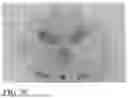 Fig. 07 - LOW DENSITY EDIBLE ANIMAL CHEWS AND METHODS OF MAKING SAME