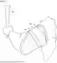 Fig. 02 - Athletic Protector