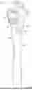 Fig. 02 - Tweezer Device
