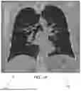 Fig. 02 - METHODS FOR PLANNING AND GUIDING ENDOSCOPIC PROCEDURES THAT INCORPORATE IMAGE-TO-BODY DIVERGENCE REDUCTION