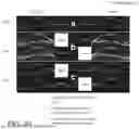 Fig. 49 - OPTICAL COHERENCE TOMOGRAPHY-BASED OPHTHALMIC TESTING METHODS, DEVICES AND SYSTEMS