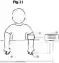 Fig. 22 - SYSTEM, APPARATUS, AND METHOD FOR EVALUATING VASCULAR ENDOTHELIAL FUNCTION