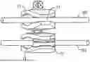 Fig. 01 - Fixation Clamp