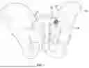 Fig. 02 - BONY FUSION IMPLANT, INSERTION INSTRUMENT, AND METHODS