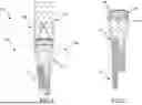 Fig. 02 - HYBRID ENDOPROSTHESIS SYSTEM