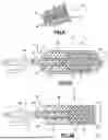 Fig. 06 - UROLOGICAL CHITOSAN STENT AND DELIVERY SYSTEM