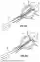 Fig. 08 - UROLOGICAL CHITOSAN STENT AND DELIVERY SYSTEM