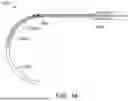Fig. 35 - EYE STENTS AND DELIVERY SYSTEMS AND METHODS