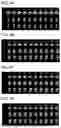 Fig. 05 - PHYSICAL METHOD AND APPARATUS FOR REGULATING MOLECULAR TRANSPORT IN BRAIN EXTRACELLULAR SPACE