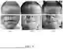 Fig. 06 - TOPICAL FORMULATIONS COMPRISING TOFACITINIB